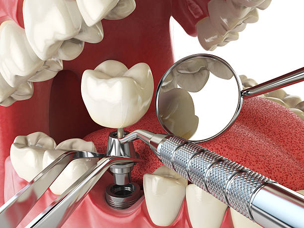 Best Urgent Tooth Repair  in Youngstown, NY